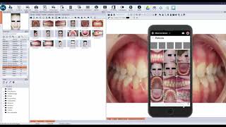 Kitview App Nº5 - Importar Docs