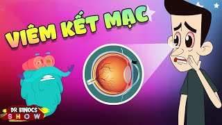 Viêm Kết Mạc Sẽ Thế Nào Nếu Mắt Bạn Đỏ Rực? Hoạt Hình Khoa Học Vui