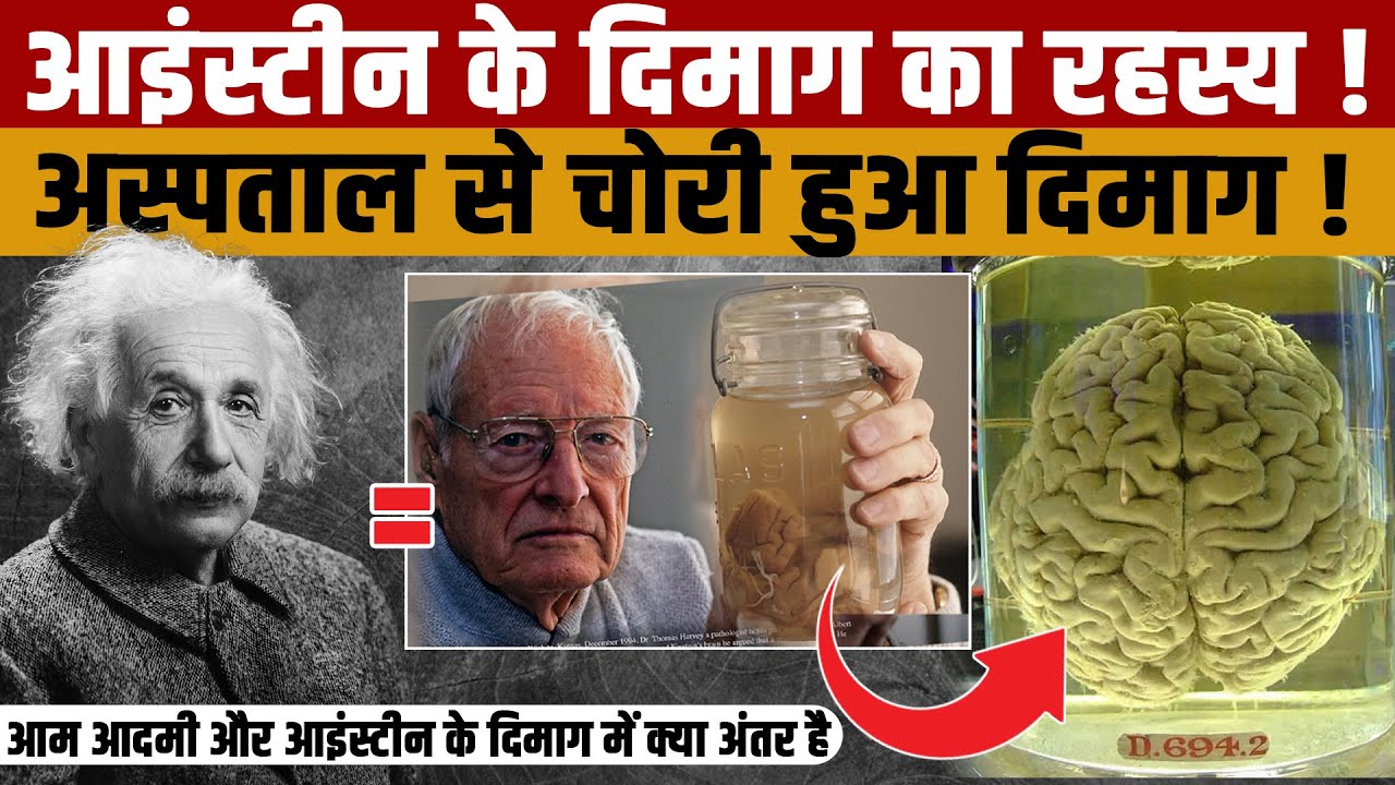 Brain of Albert Einstein | अल्बर्ट आइंस्टीन के दिमाग चोरी होने और दिमाग के 240 टुकड़े की पूरी कहानी