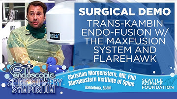 Trans-Kambin Endo Fusion with the MaxFusion System & Flarehawk -  Christian Morgenstern, M.D., Ph.D