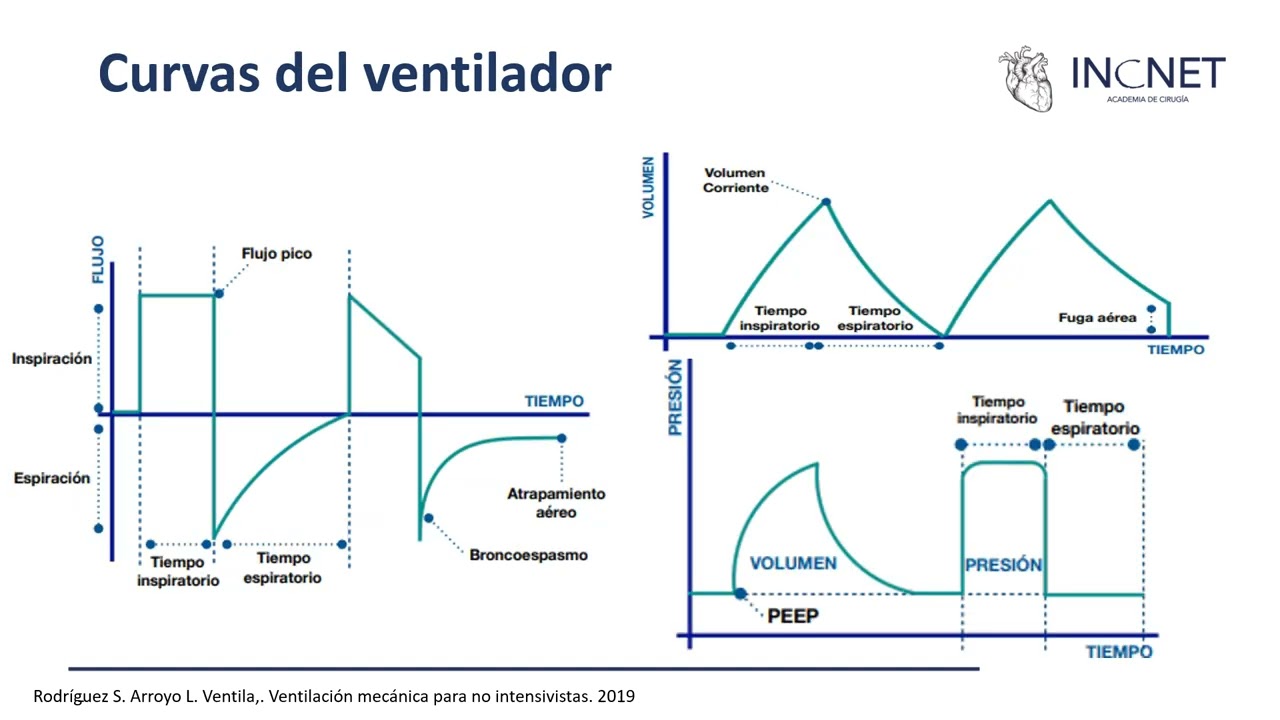 Ventilación mecánica