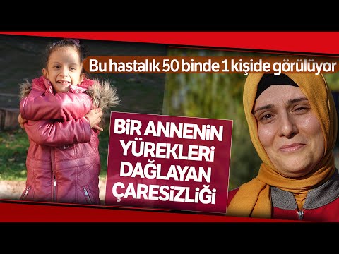 Video: Wolf Hirschhorn Sendromu nasıl teşhis edilir?