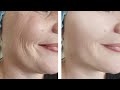 Just 1 Skin Tightening and Face lifting Home Remedy | Face Pack For Loose Facial Skin