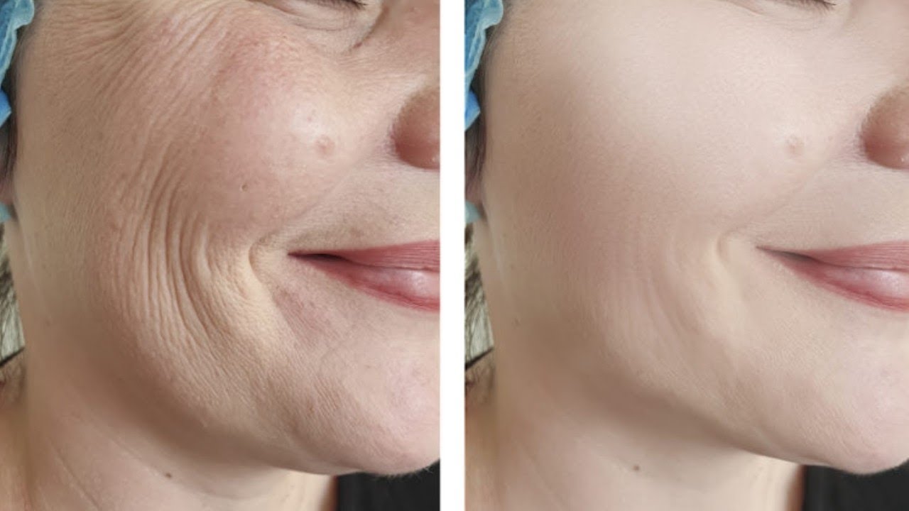 how to tighten face skin naturally at home