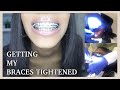 Getting My Braces TIGHTENED For The First Time | How To Prepare Yourself and What To Expect