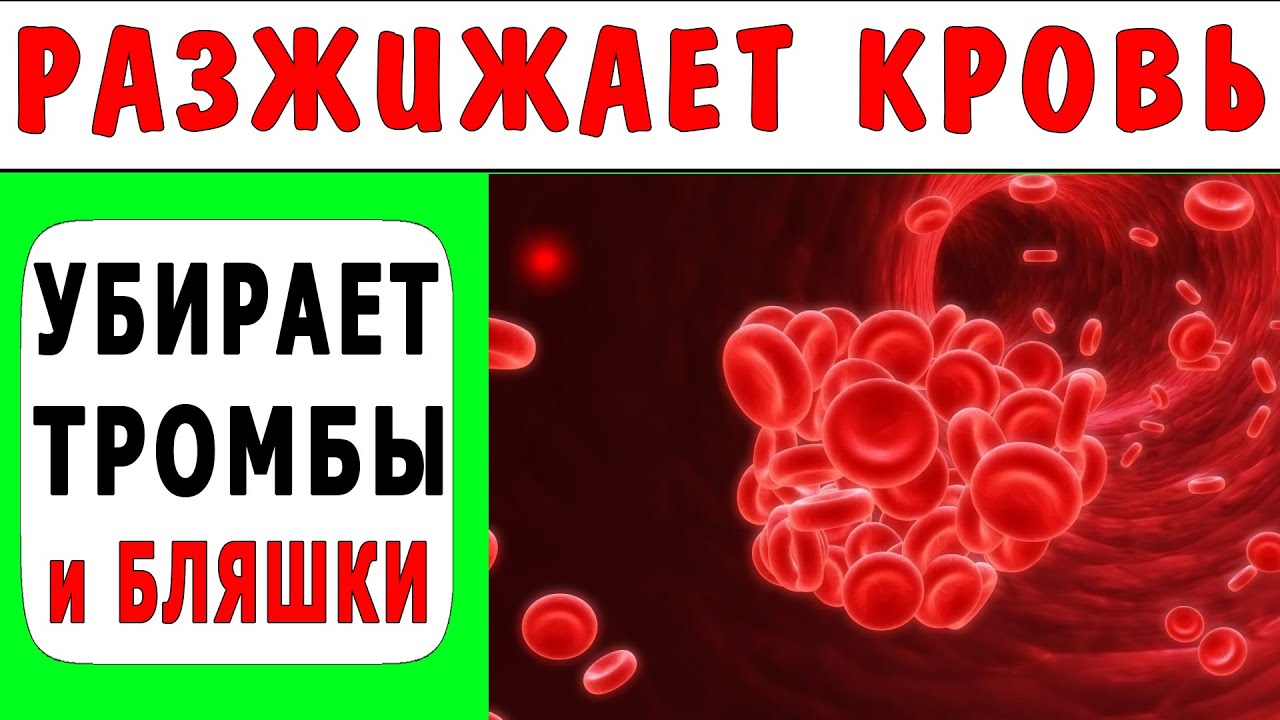 Что Разжижает Кровь и Убирает Тромбы в Домашних Условиях - YouTube
