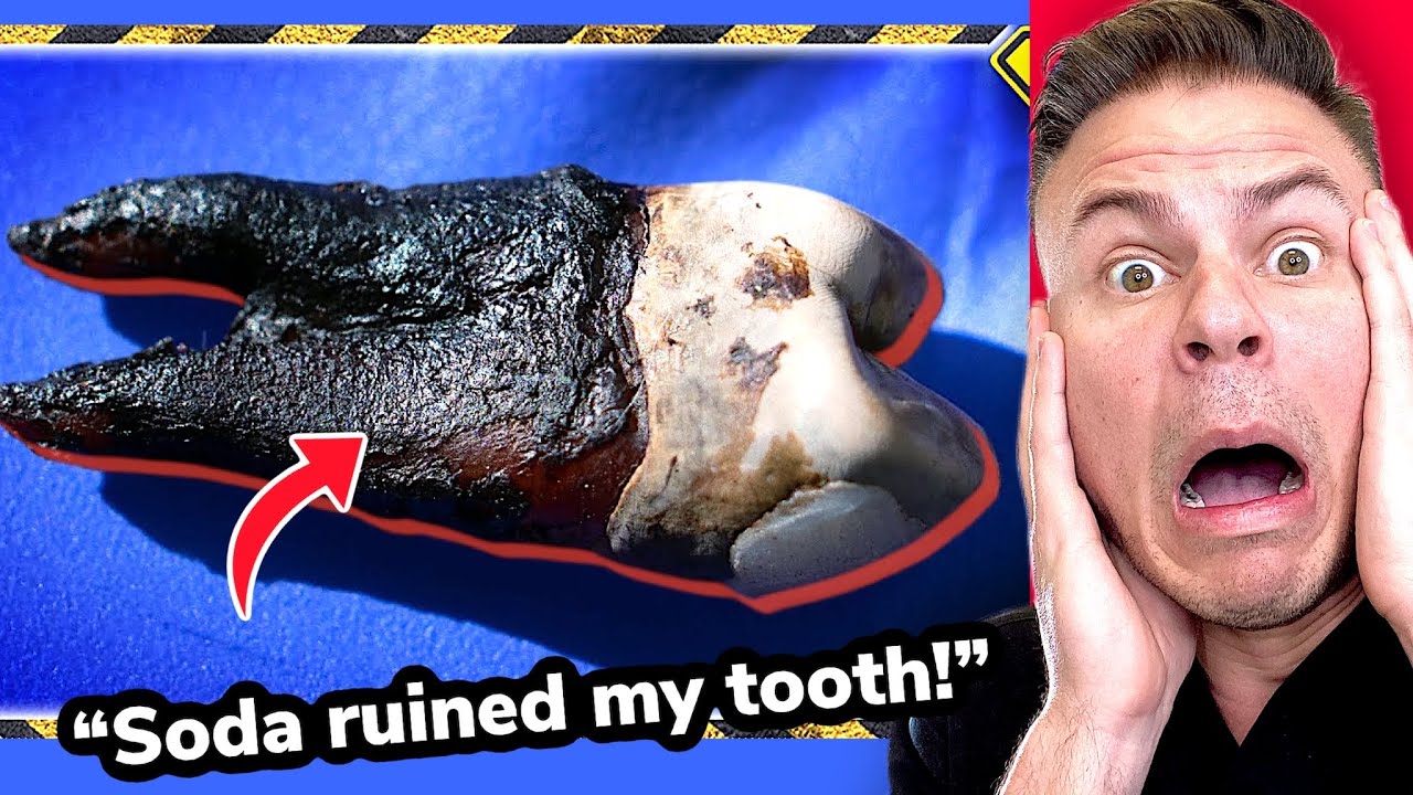 Orthodontist Reacts! What Does Coke REALLY Do To Your Teeth?