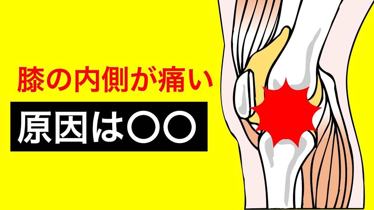 Osteoarthritis of the knee] Causes of pain on the inside of the