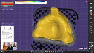 How to make a Custom Tray or Baseplate in Exocad