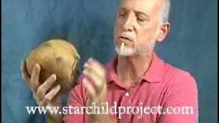 Starchild Cheeks and Neck Discussed