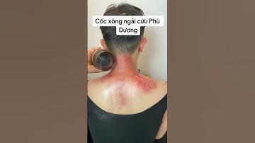 Cốc Phù Dương xông ngải cứu Massage cạo gió.Ai mua hàng thì vào đây nhé Https://thietbidienchan.com