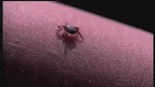 Doctors and veterinarians concerned about tick-borne illnesses Pt.1