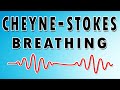 Breathing in waves understanding cheynestokes respiratory rhythm