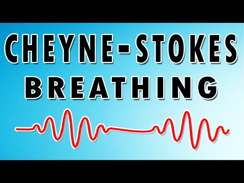 Cheyne Stokes Breathing Pattern (Causes, Sound and Treatment)