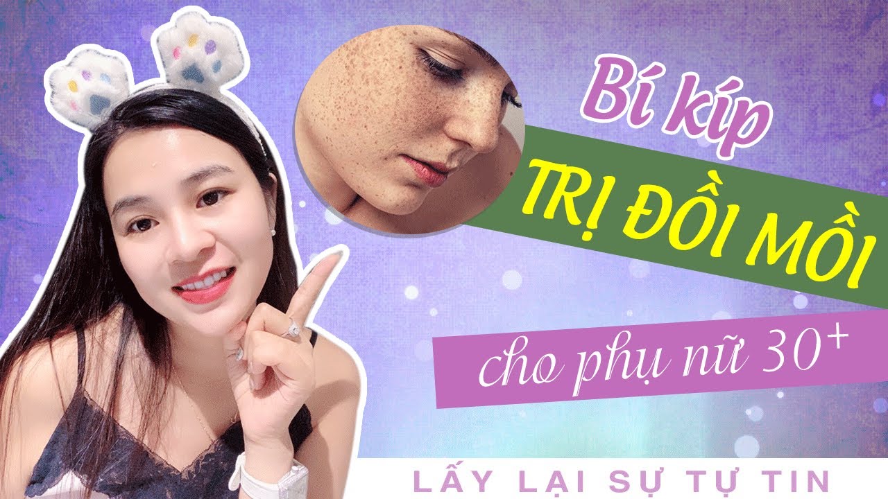 Cách hết sạch Đồi mồi lấy lại sự tự tin cho Phụ nữ sau... - youtube