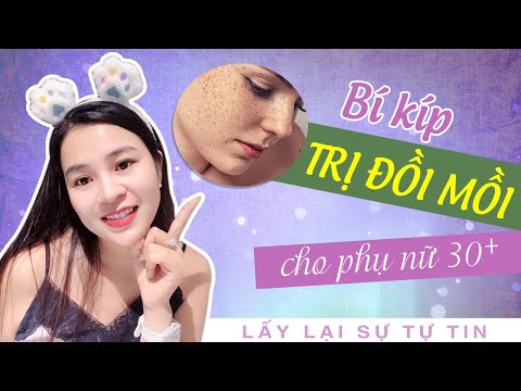Video Cách hết sạch Đồi mồi lấy lại sự tự tin cho Phụ nữ sau... - youtube