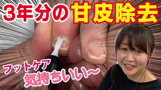 【フットケア】3年分の甘皮除去と角質除去をやったら結構すごかった！※閲覧注意[footcare][ネイリスト][まきちゃんねる]