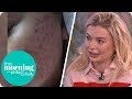 Toff Bravely Removes Her Makeup as She Seeks Help for Her Problem Skin | This Morning