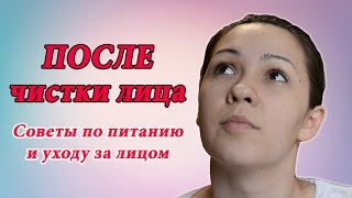 ПОСЛЕ ЧИСТКИ ЛИЦА. Советы косметолога. Уход за лицом, диета и лечение после механической чистки лица(Как выглядит лицо после механической чистки лица? Как ухаживать за лицом после чистки и как правильно питат..., 2016-02-13T14:26:53.000Z)