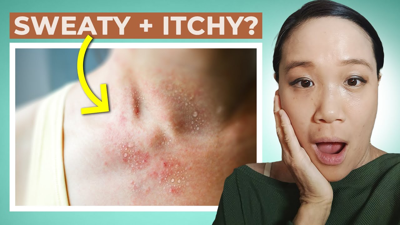 Why Your Skin Itches When You Sweat REVEALED YouTube Why Your Skin Itches When You Sweat REVEALED YouTube