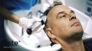 Hair Transplant Simon Este Medical Group
