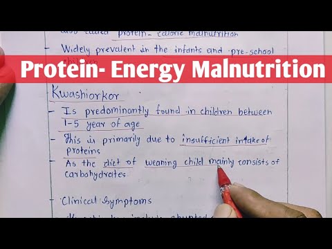 Protein - Energy Malnutrition | Kwashiorkor | Marasmus | Biochemistry