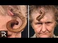 Shocking Medical Conditions You Won't Believe Exist