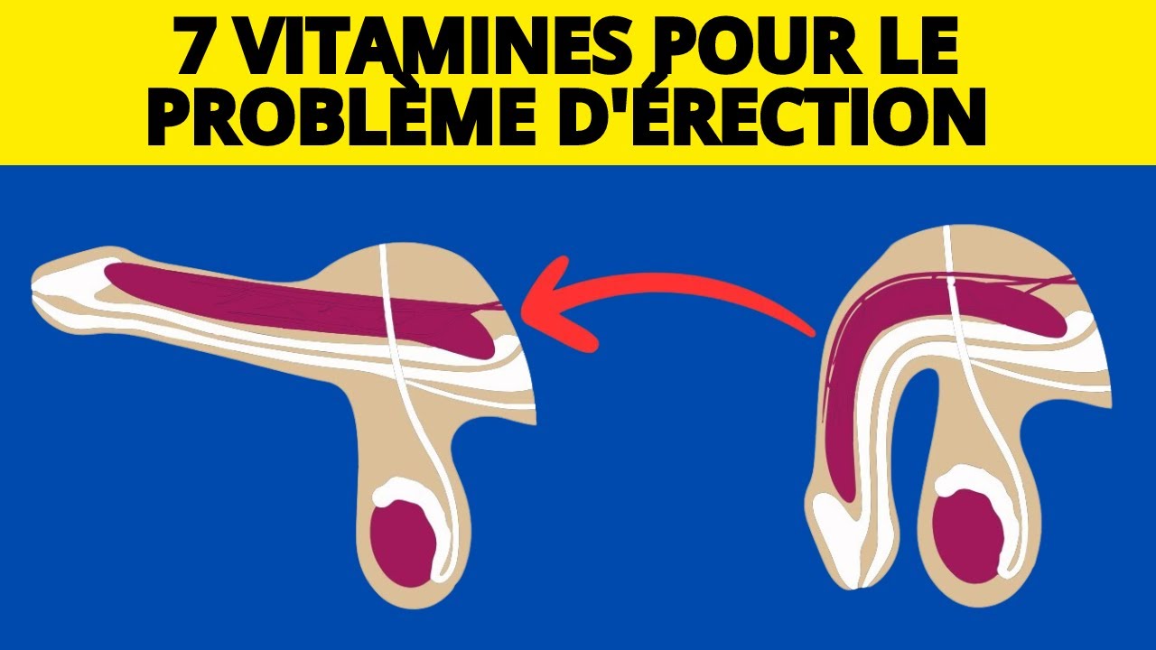 7 VITAMINES POUR LE PROBLÈME D'ÉRECTION DYSFONCTION ÉRECTILE ALIMENTS