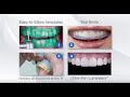 The additive reductive template art stepbystep process  denmat dental lab