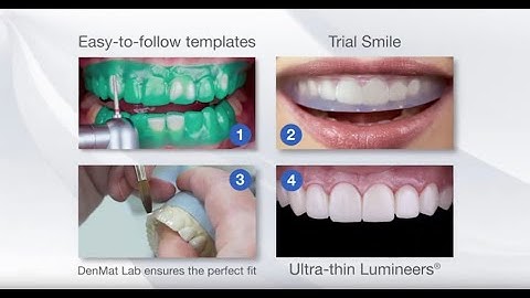 The Additive Reductive Template (ART) Step-By-Step Process - DenMat Dental Lab