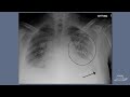 CME365 מציג הסבר ברור על רפואת הריאות CME365 מציג הסבר ברור על רפואת הריאות
