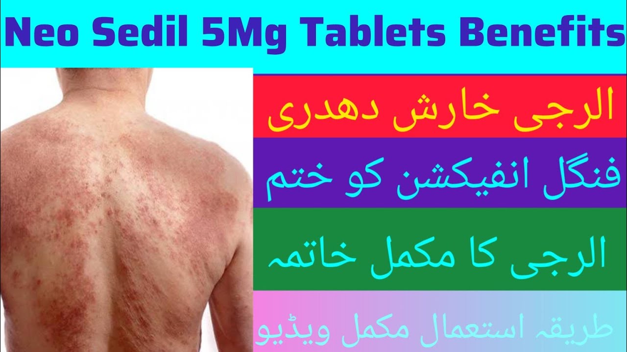 Neo Sedil Tablets Uses In Urdu | Levocetirizine | Neo Sedil Tablets Uses Benefits | Anti Allergic |