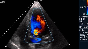 Viewing a cardiac ultrasound doppler (Dicom multiframe) on medview