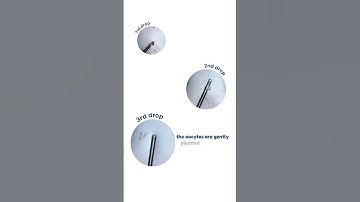 Oocyte Denudation - Lab Procedures | #newlifeivfgreece
