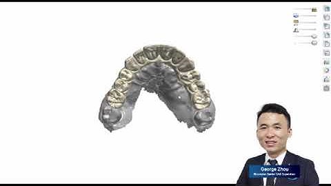 Full Arch Implant Hybrid Design by 3shape