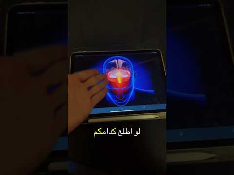 منو جان يدري بيها ؟ #طب #اكسبلور #كلية_طب #العاب #كليه #ترند #doctor