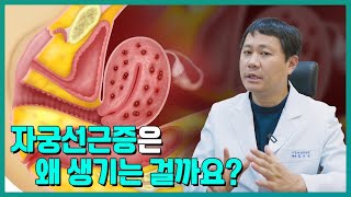 자궁선근증 왜 생기는 걸까? 원인에 대해서 알아봐요