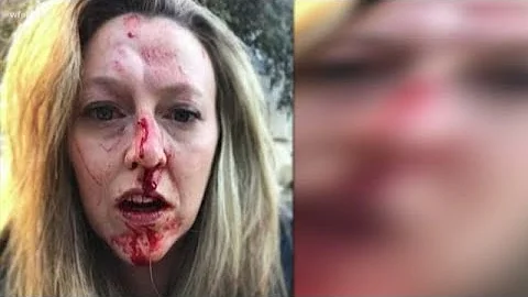 Women describe pattern of attacks by man arrested ...