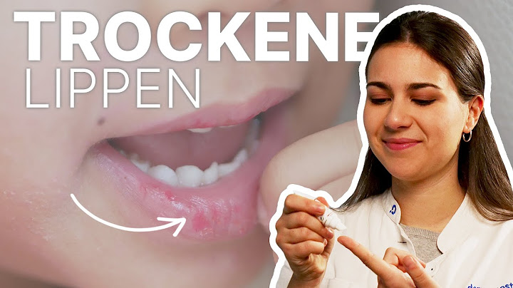 Was bedeuten spröde ganz trockene lippen