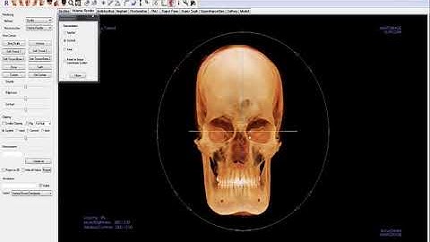 Invivo™ 5.4.5 Training Series: Introduction to SuperPano