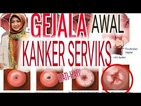 Video: Apakah yang dimaksudkan dengan endoserviks?