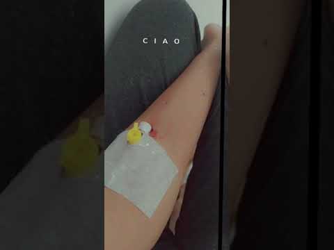 Hastanede serumlu kol whatsApp status