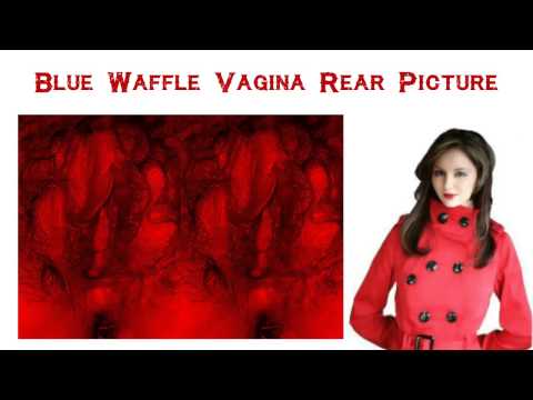Blue Waffle Vagina - VAG