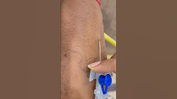 LOCATING DIFFICULT VEINS FOR IV CANNULATION | IV CANNULA