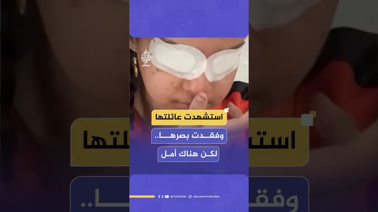 فقدت والديها وإخوتها وبصرها بغارة إسرائيلية