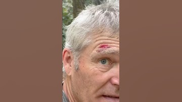 Reminder why an Emergency Kit Should Be Brought on a Wild Survival Challenge!