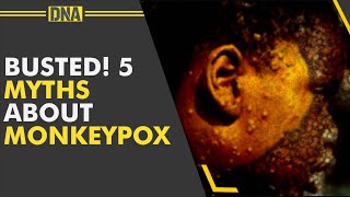 Monkeypox is transmitted only through monkeys? 5 myths about the new viral infection