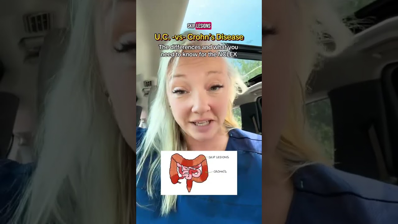 UC vs Crohn's Disease!  Know this for the NCLEX