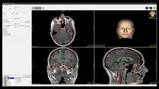 Analyze 15.0 - Measure: Selected Object