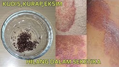 Tak Usah Ke Dokter Kulit!! Cukup Oleskan Ini Gatal gatal & Penyakit Kulit Menahun Hilang Seketika - Durasi: 4.31. Tak Usah Ke Dokter Kulit!! Cukup Oleskan Ini Gatal gatal & Penyakit Kulit Menahun Hilang Seketika - Durasi: 4.31.